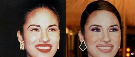 selena quintanilla surgery|Murder of Selena